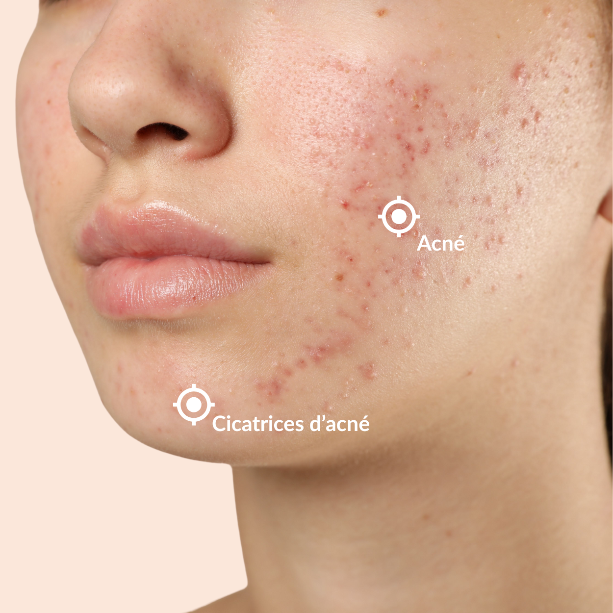 Duo Glow Anti-Imperfecties met Kurkuma