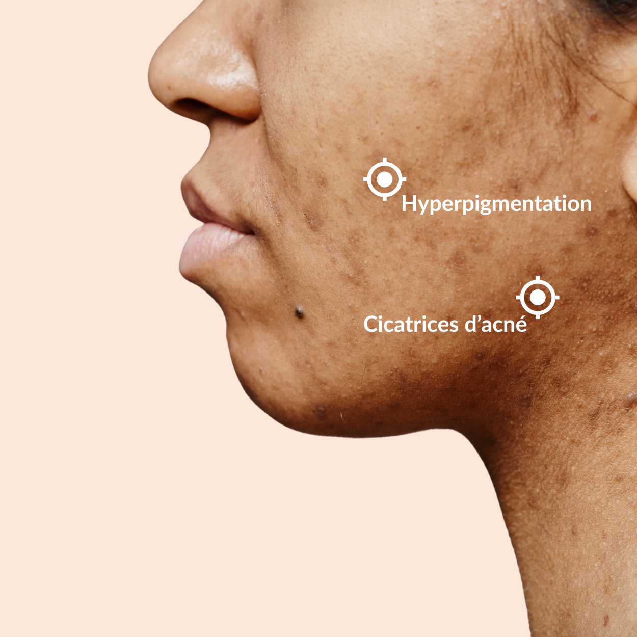 Duo Glow Anti-Imperfecties met Kurkuma